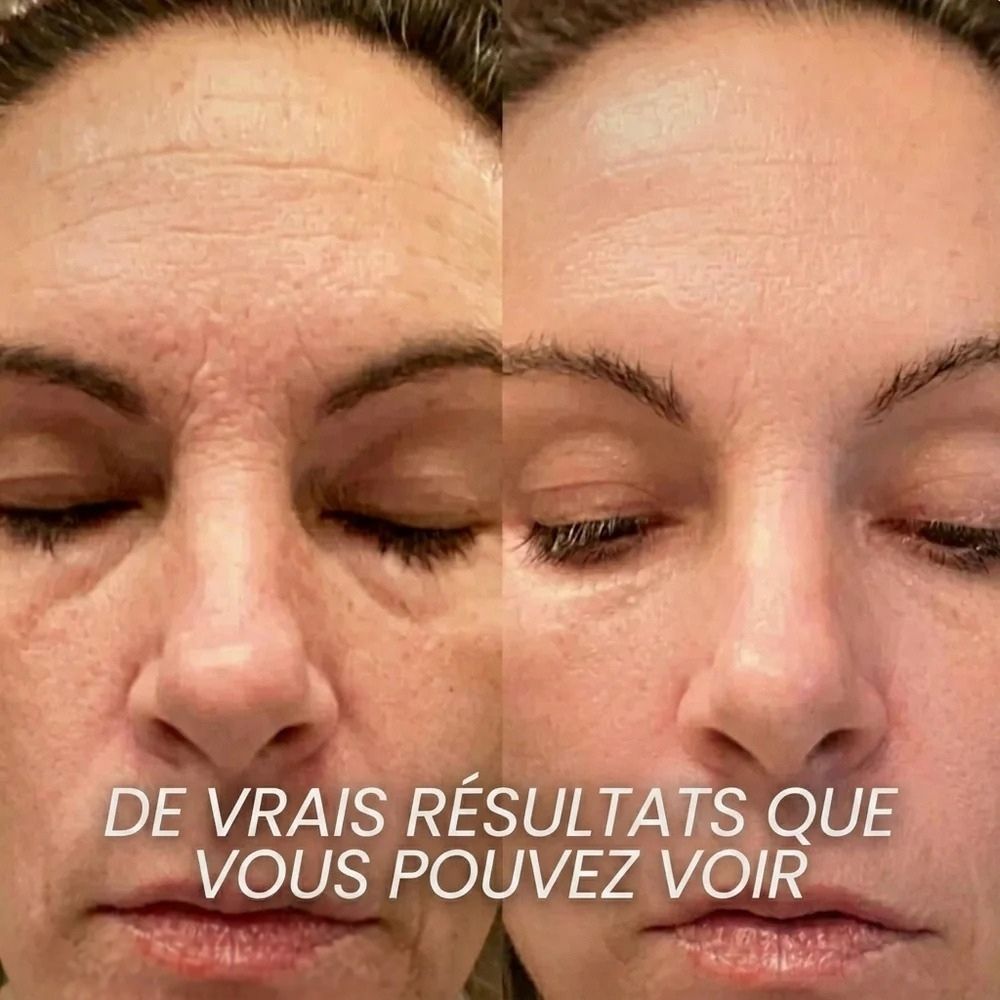 Stick Repulpant Bio-Collagène PDRN